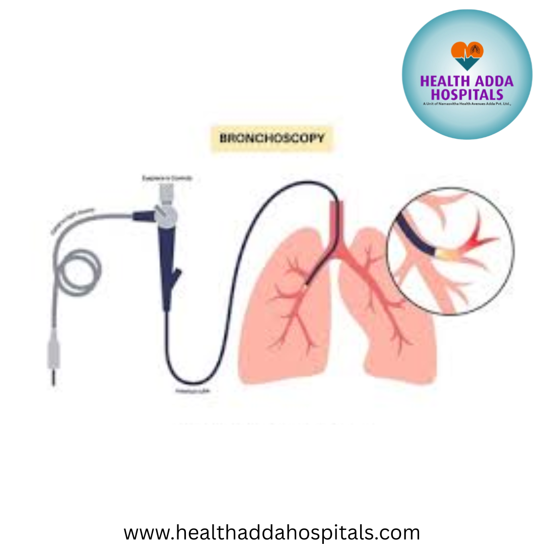 Bronchoscopy Specialist Hyderabad