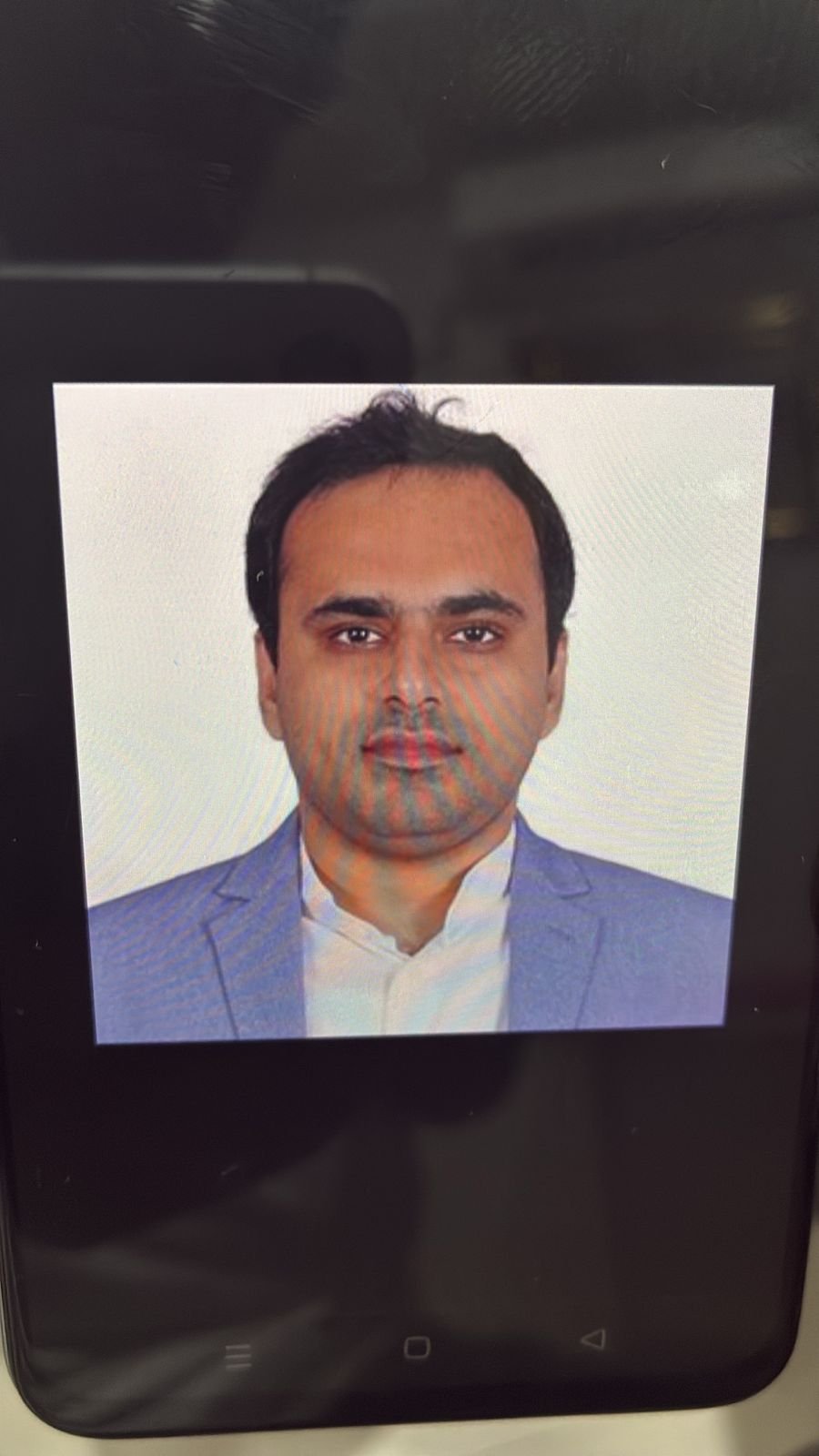 Dr Shiva Ram Rao Neurologist in Hyderabad